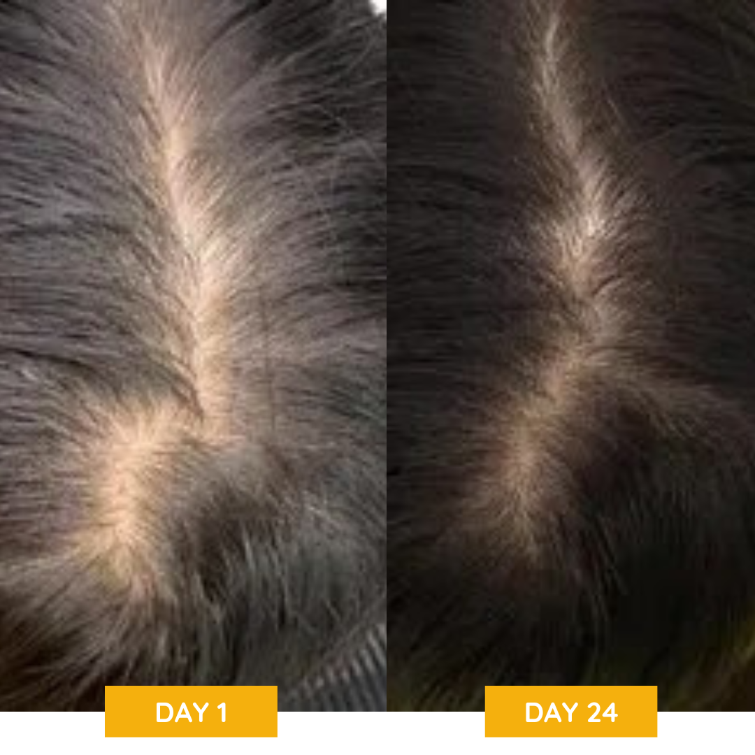 Neviux™ Hair Growth Conditioner