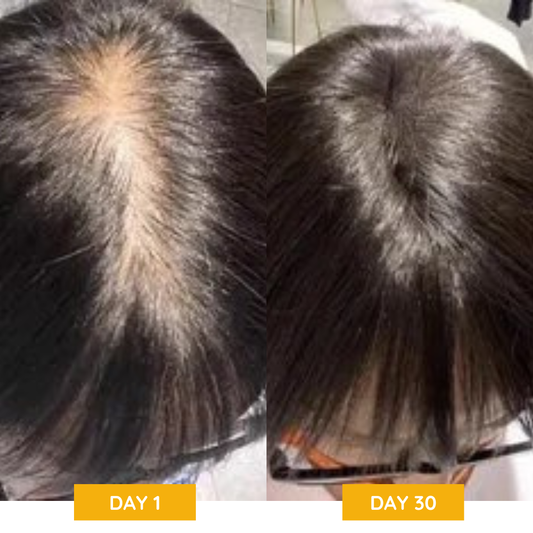 Neviux™ Hair Growth Shampoo