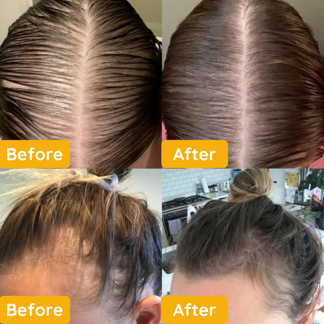 Neviux™ Natural Hair Growth Oil