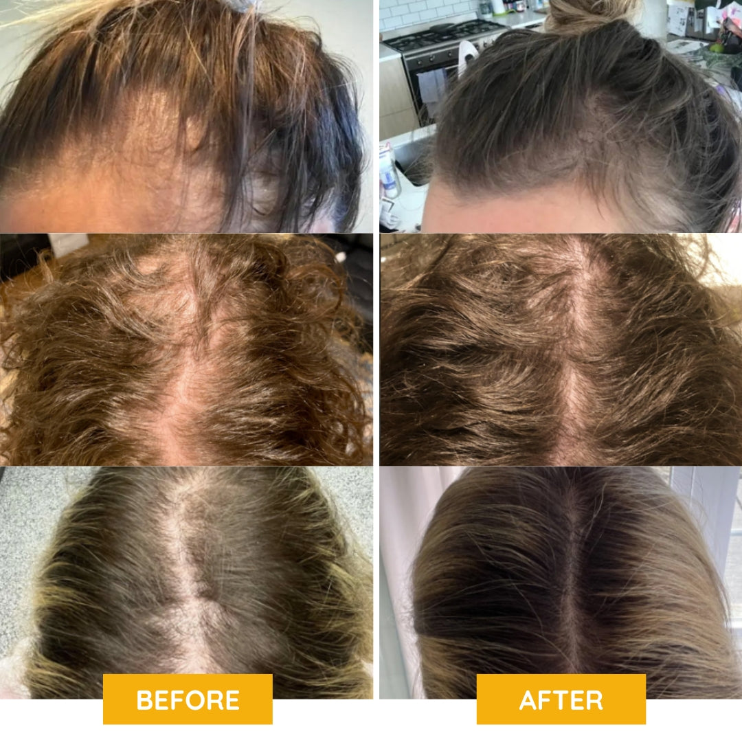 Neviux™ Hair Growth Oil