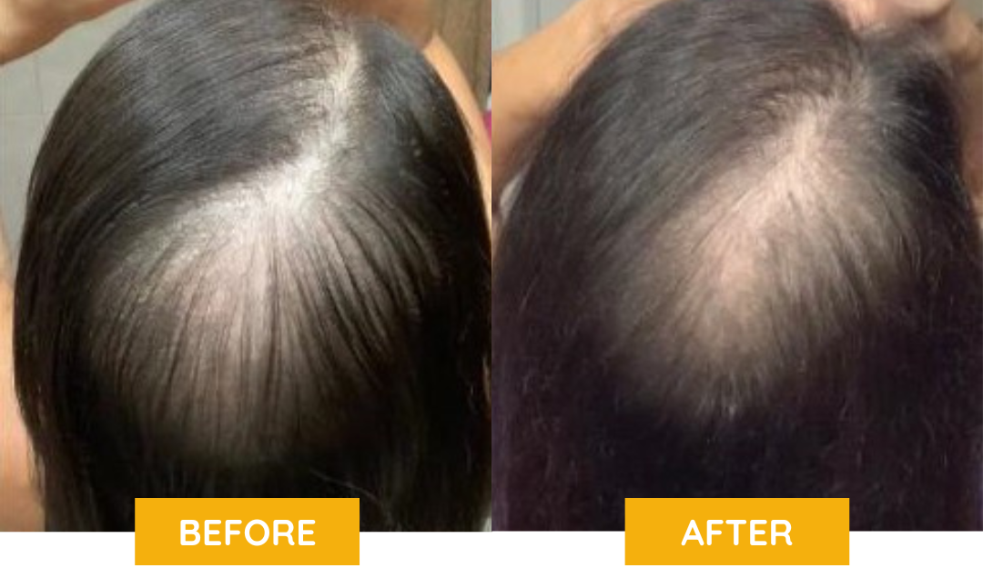 Neviux™ Hair Growth Oil